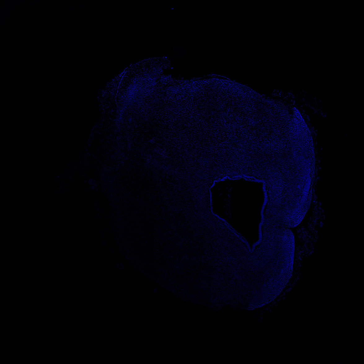 Human foetal midbrain